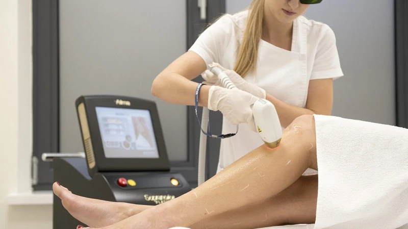 Qué es la depilación láser y cómo funciona el método